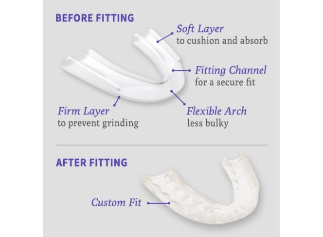 The Doctor's Placa Dentária Miorrelaxante para Bruxismo NightGuard The Doctor's Placa Dentária Miorrelaxante para Bruxismo NightGuard